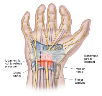 Carpal tunnel syndrome anatomy